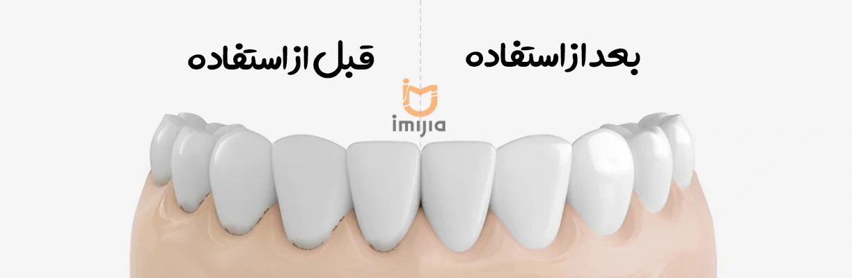 دستگاه شستشو دهنده دهان و دندان شیائومی مدل Xiaomi Water Flosser 2